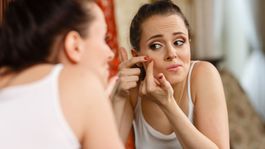 Aj tieto štyri zlozvyky zapríčiňujú vznik akné!