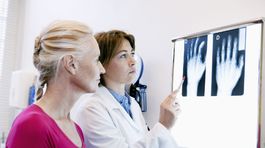 Bolia nohy? Možno za to môže strata chrupavky