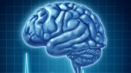 Hudba a tanec trénujú mozog