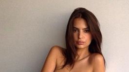 Natriasať sa zase hore bez? Dnes by asi táto kráska povedala nie!