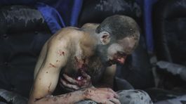 Sýria, zranení