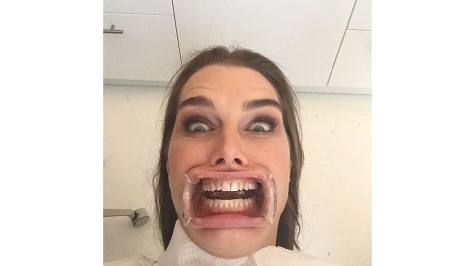 Brooke Shields na selfie zo zubárskeho kresla.