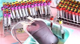 Toto je moja krv: Ste plus alebo mínus?