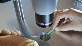 Holandský lekár používal na umelé oplodnenia svoje spermie