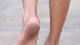 Protéza vrátila nohe cit