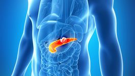 Karcinóm pankreasu: Zlá rakovina