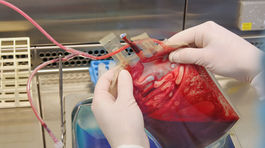 V lete je nedostatok krvi