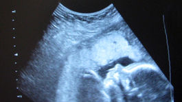 Na palube lietadla sa narodilo bábätko. Aké bude mať vlastne občianstvo?