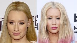 Veď ona je úplne iná! Rok uplynul a raperka Azalea sa mení plastikami