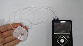 Nová pumpa pre diabetikov vopred upozorní na riziko kolapsu