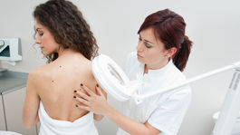 Melanóm ohrozuje čoraz viac ľudí. Lekári varujú pred nadmerným slnením