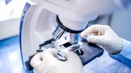 Najstarší predchodca človeka je vraj milimetrový saccorhytus