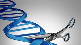 Obezitu chcú liečiť vystrihnutím kúska DNA