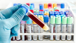 Som nula. A pozitívna. Poznať si svoju krvnú skupinu má význam