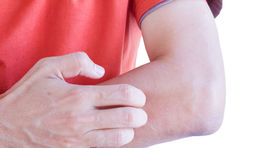 Ekzém nevyliečime, ale zmierniť ho vieme