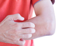 Nádej pre ľudí s nepríjemnou a bežnou...