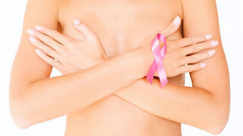prsia, rakovina prsníka