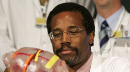 USA: Trumpa v prieskumoch predbehol Carson