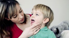 Afty. Biele vriedky v ústach veľmi bolia