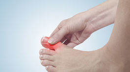 Dna - ochorenie, ktoré bolestivo kričí: Nejedz mäso!