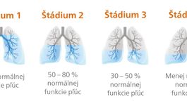 Rozdýchavate dlhšie, ako je zdravé?