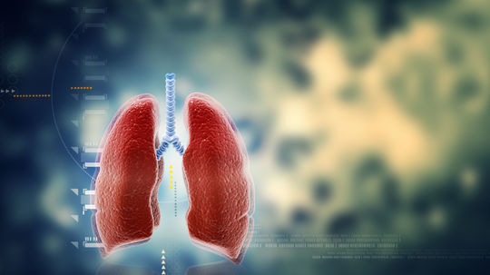 Rakovina pľúc zabíja každé štyri hodiny