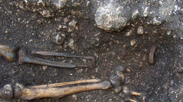 Rakúski archeológovia vykopali najstaršiu európsku protézu