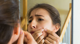 Problematická pleť a akné? Tieto chyby ženy robia často, vraví odborníčka