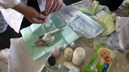 UNICEF: Najmenej 200 miliónov žien vo svete absolvovalo ženskú obriezku