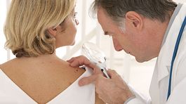 Psoriáza: Druhy, príčiny, spúšťacie faktory a liečba