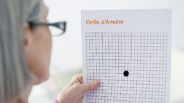 Ktorá forma degenerácie makuly je horšia? Suchá či vlhká?