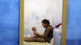 V Brazílii poklesol počet prípadov mikrocefálie spájaných s vírusom