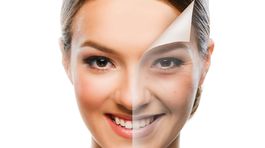 Argánový olej posilňuje imunitu, zmierňuje ekzém a akné