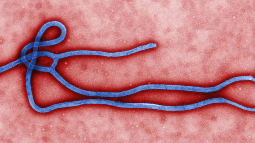 ebola, mikroskop, vírus