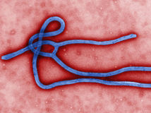ebola, mikroskop, vírus