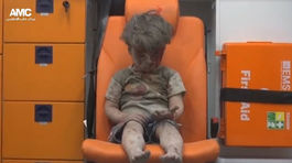 Video zo záchrany malého chlapca ukazuje hrôzy sýrskej vojny