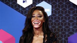 Modelka Winnie Harlow.