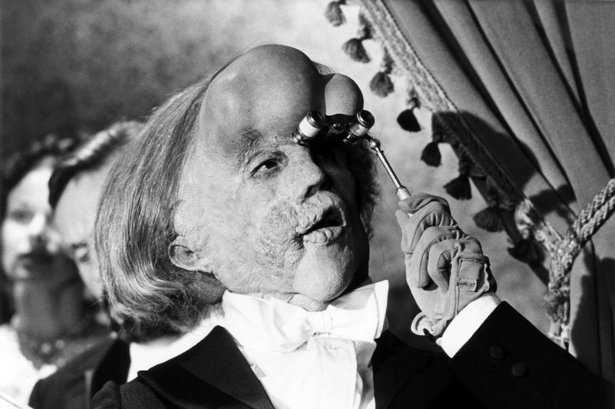 John Hurt vo filme Sloní muž (1980).