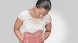 Kolorektálny karcinóm: Najčastejší zhubný nádor