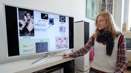 Mladá vedkyňa opravuje bunky a bojuje proti rakovine