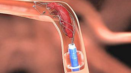 Medicínske technológie dokážu vrátiť ľudí späť do života