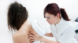 Otázky a odpovede: O rakovine kože