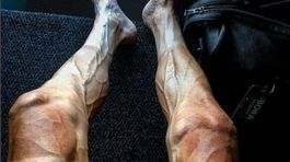 Šokujúca snímka rozvírila diskusie. Čo môže za zničené nohy cyklistu? 