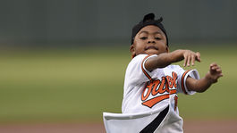 Chlapec z Baltimoru sa naučil žiť s novými rukami