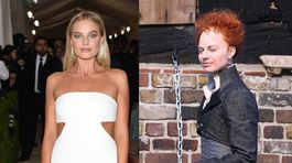 Plešina, akné a zlá pleť! Toto spravili zo sexbomby z Vlka z Wall Street!