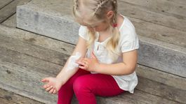 Otázky a odpovede: Čo možno neviete o atopickom ekzéme