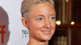 A toto má byť čo?! Britská herečka šokovala podivnou úpravou