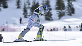 Celé Slovensko drží palce! Velez-Zuzulovú čaká unikátna operácia