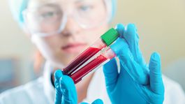 To, či do desiatich rokov zomrieme, určí test krvi