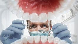 Sedemročný chlapec mal v ústach o 526 zubov naviac